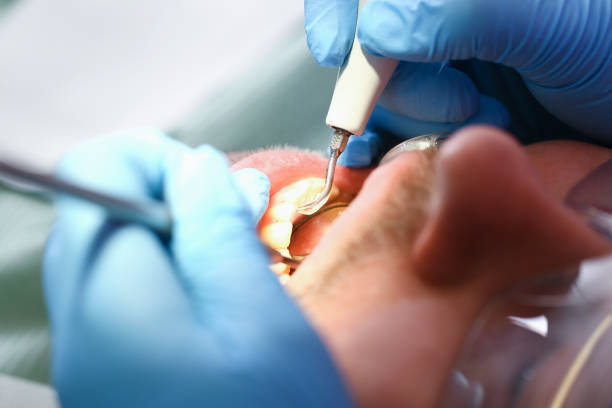 Best Emergency Denture Repair in Hugo, MN