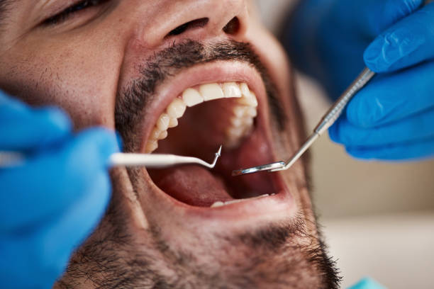 Best Emergency Dental Care for Sports Injuries in Hugo, MN